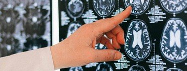 Nuestro cerebro tiene su propia copia de seguridad. Ya se conoce cómo crea copias en paralelo de cada recuerdo