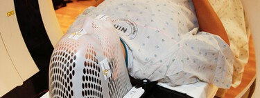 Los cánceres en jóvenes se han disparado casi un 80% en 30 años. Es un dato que hay que coger con pinzas